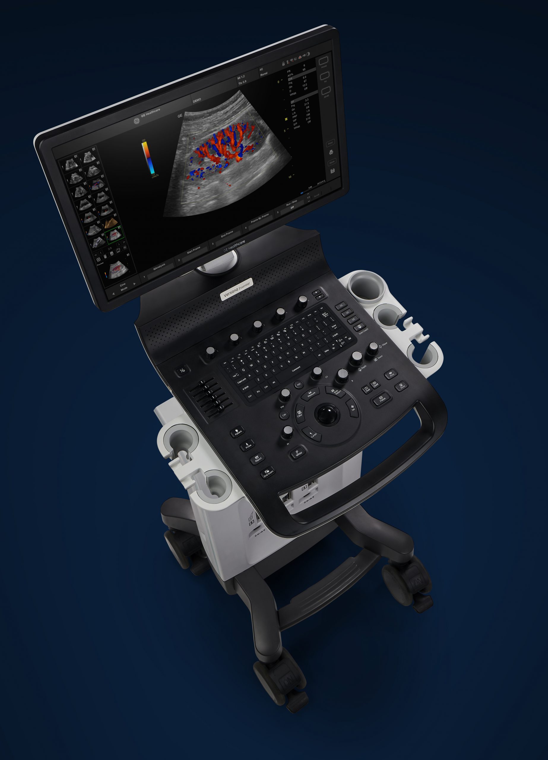 GE Versana Essentials Ultraschallgerät Aktionspreis Aktionsangebot