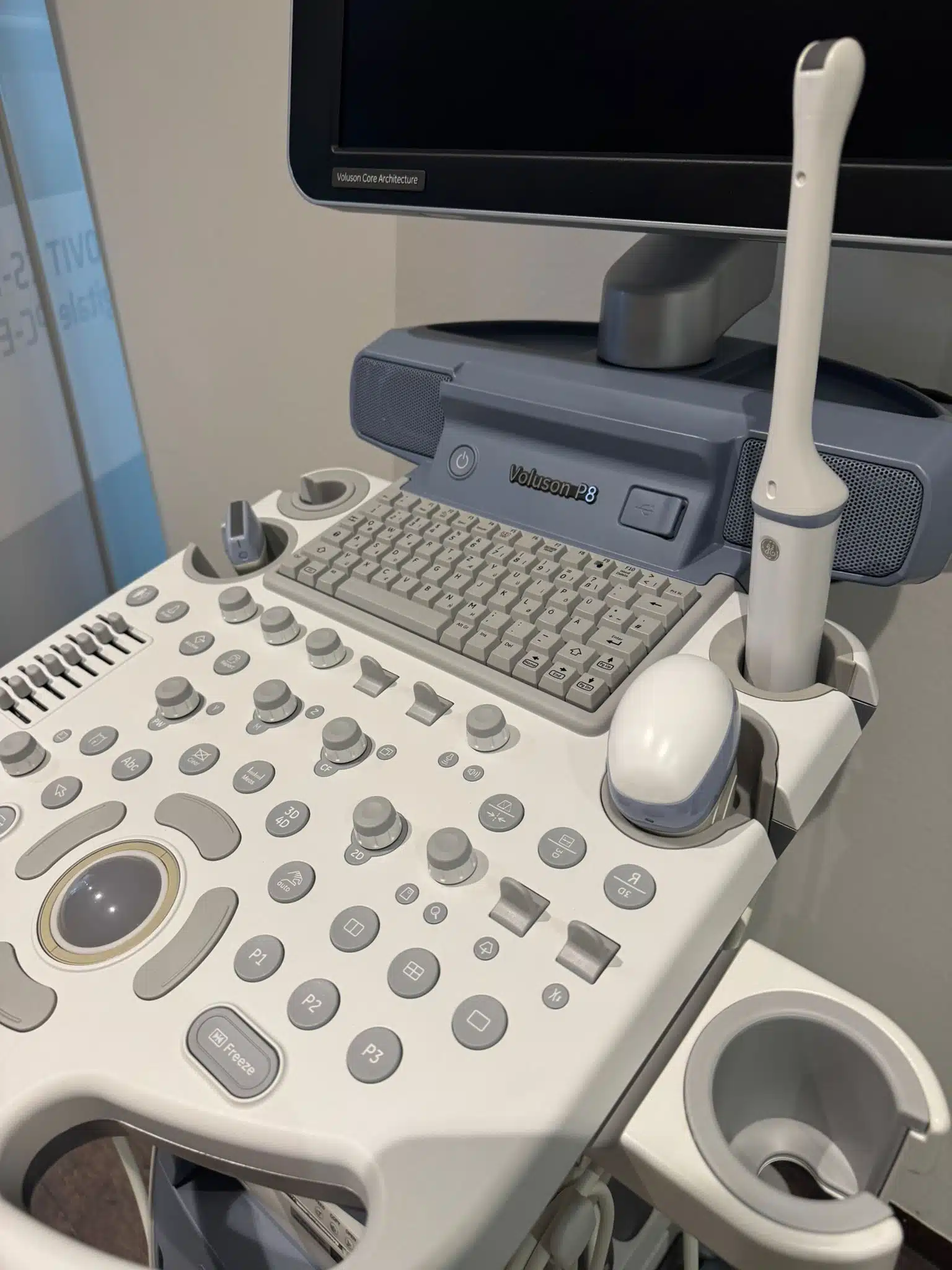 Voluson P8 gebrauchtes generalüberholtes Ultraschallgerät Frauenheilkunde Gynäkologie Prenataldiagnostik