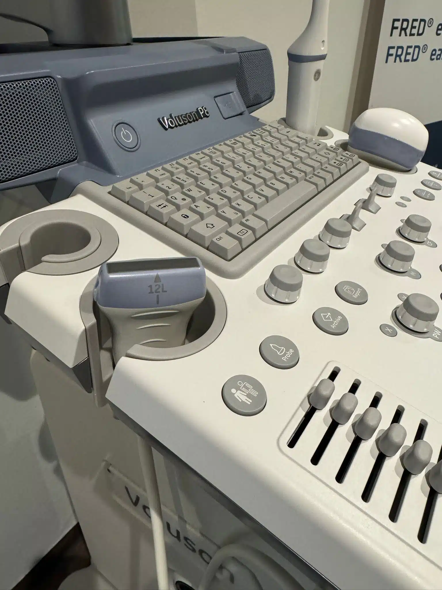 Voluson P8 gebrauchtes generalüberholtes Ultraschallgerät Frauenheilkunde Gynäkologie Prenataldiagnostik