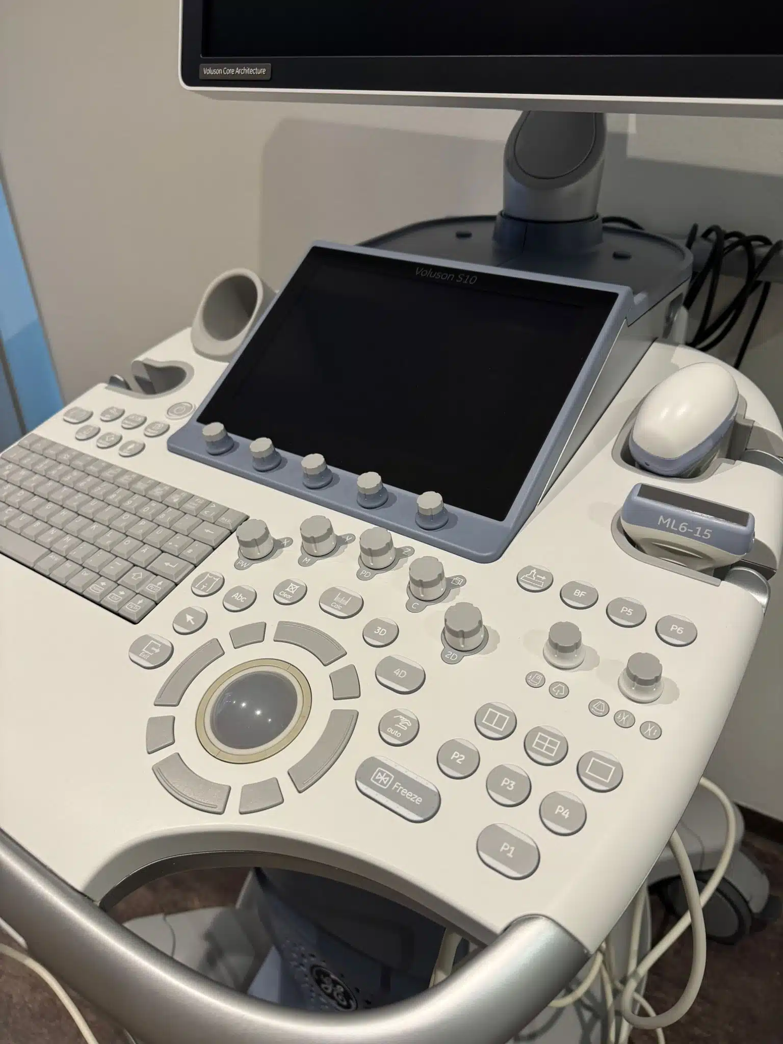 Voluson S10 gebrauchtes generalüberholtes Ultraschallgerät Frauenheilkunde Gynäkologie Prenataldiagnostik